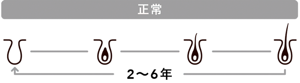 agacycle1b