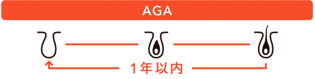 agacycle2b